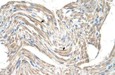 Immunohistochemistry-Paraffin: CKMT2 Antibody [NBP1-54661]