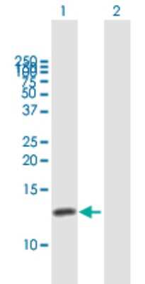 Western Blot: CKS1 Antibody [H00001163-B01P]