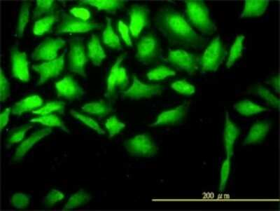 Immunocytochemistry/ Immunofluorescence: CKS2 Antibody (2H5-2C4) [H00001164-M01]