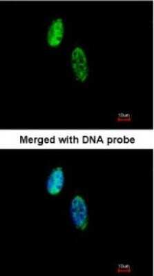 Immunocytochemistry/ Immunofluorescence: CKS2 Antibody [NBP1-33404]