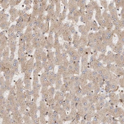 Immunohistochemistry-Paraffin: CL-K1/COLEC11 Antibody [NBP1-81120]
