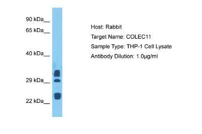 Western Blot: CL-K1/COLEC11 Antibody [NBP2-82698]