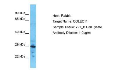 Western Blot: CL-K1/COLEC11 Antibody [NBP2-82705]