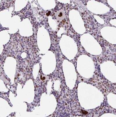 Immunohistochemistry-Paraffin: CLP1/HEAB Antibody [NBP2-33847]