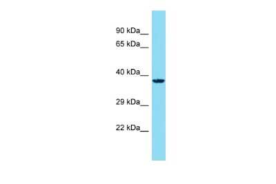 Western Blot: CLBA1 Antibody [NBP2-84688]