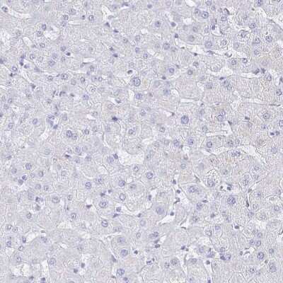 Immunohistochemistry-Paraffin: CLCA1 Antibody [NBP2-38869]
