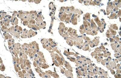 Immunohistochemistry-Paraffin: CLCC1 Antibody [NBP1-59834]
