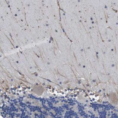 Immunohistochemistry-Paraffin: CLCC1 Antibody [NBP1-82792]