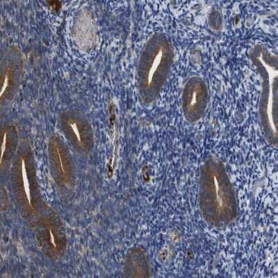 Immunohistochemistry-Paraffin: CLCC1 Antibody [NBP1-82792]