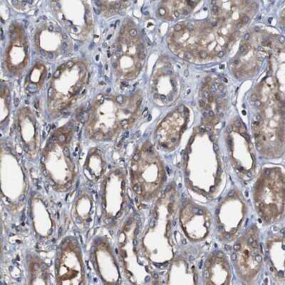 Immunohistochemistry-Paraffin: CLCC1 Antibody [NBP1-82792]