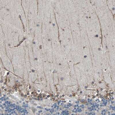 Immunohistochemistry-Paraffin: CLCC1 Antibody [NBP1-82793]