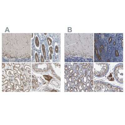 Immunohistochemistry-Paraffin: CLCC1 Antibody [NBP1-82793]