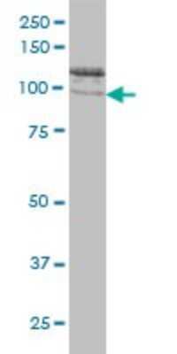 Western Blot: CLCN2 Antibody (3E1) [H00001181-M01]