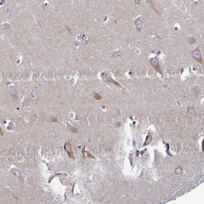 Immunohistochemistry-Paraffin: CLCN3 Antibody [NBP1-91790]
