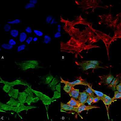 Immunocytochemistry/ Immunofluorescence: CLCN3 Antibody (S258-5) [NBP2-59379]