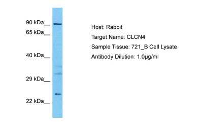Western Blot: CLCN4 Antibody [NBP2-84633]