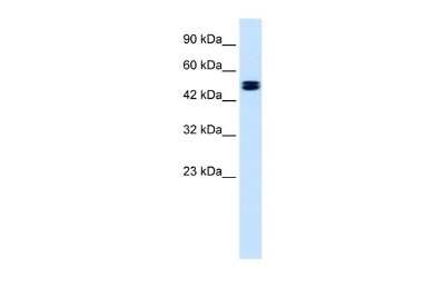 Western Blot: CLCN6 Antibody [NBP2-84690]