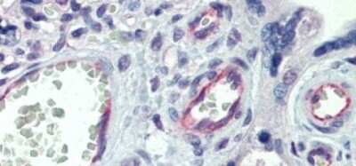 Immunohistochemistry-Paraffin: Claudin-23 Antibody [NBP1-70500]