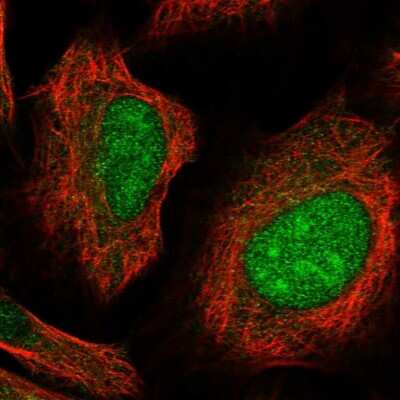 Immunocytochemistry/ Immunofluorescence: CLDND1 Antibody [NBP1-86790]