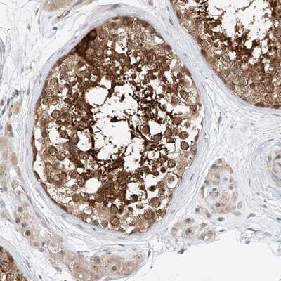 Immunohistochemistry-Paraffin: CLDND1 Antibody [NBP1-86790]