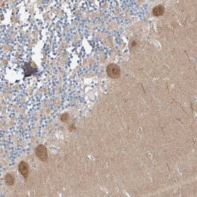 Immunohistochemistry-Paraffin: CLDND1 Antibody [NBP1-86790]