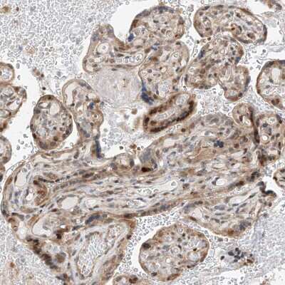 Immunohistochemistry-Paraffin: CLDND1 Antibody [NBP1-86790]
