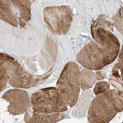 Immunohistochemistry-Paraffin: CLDND1 Antibody [NBP1-86790]