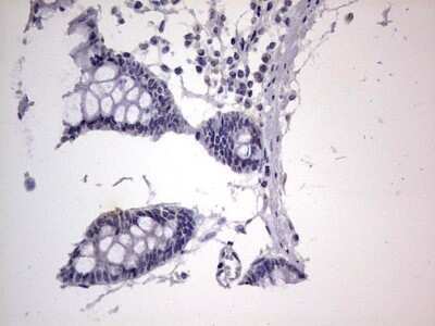 Immunohistochemistry: CLE7 homolog Antibody (OTI2A4) - Azide and BSA Free [NBP2-71940]