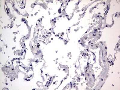 Immunohistochemistry: CLE7 homolog Antibody (OTI2A4) - Azide and BSA Free [NBP2-71940]