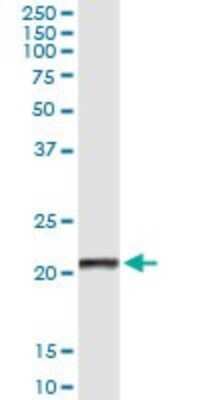 Immunoprecipitation: CLEC-2/CLEC-1B Antibody (1C10) [H00051266-M02]