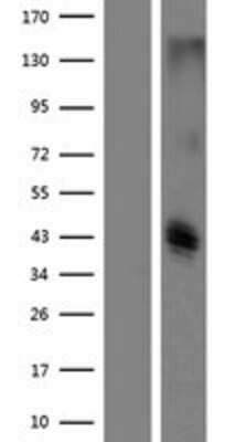 Western Blot: CLEC12B Overexpression Lysate [NBP2-09494]