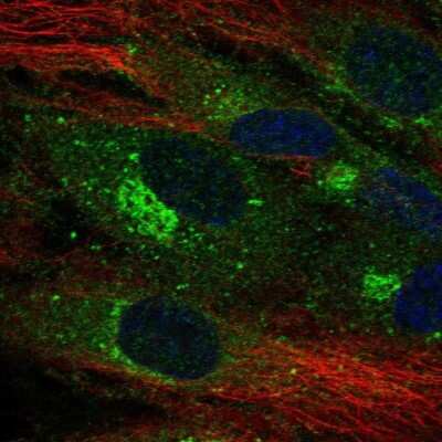 Immunocytochemistry/ Immunofluorescence: CLEC14A Antibody [NBP2-30854]