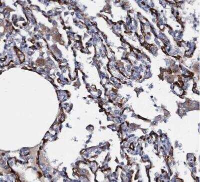 Immunohistochemistry-Paraffin: CLEC14A Antibody [NBP2-30854]