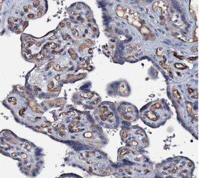 Immunohistochemistry-Paraffin: CLEC14A Antibody [NBP2-30854]
