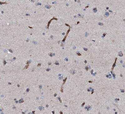 Immunohistochemistry-Paraffin: CLEC14A Antibody [NBP2-30854]