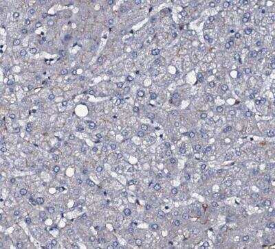 Immunohistochemistry-Paraffin: CLEC14A Antibody [NBP2-30854]