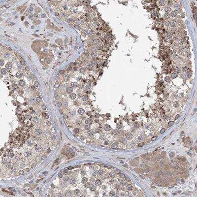 Immunohistochemistry-Paraffin: CLEC16A Antibody [NBP1-81806]