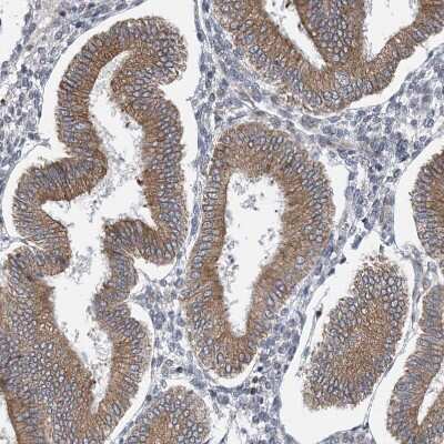 Immunohistochemistry-Paraffin: CLEC16A Antibody [NBP1-81806]