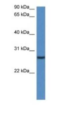 Western Blot: CLEC-2/CLEC-1B Antibody [NBP1-79203]