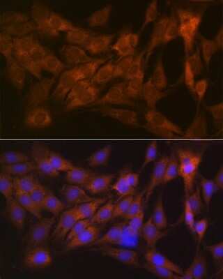 Immunocytochemistry/ Immunofluorescence: CLEC3B/Tetranectin Antibody (3E5Y7) [NBP3-16399]