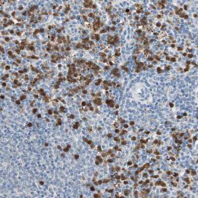 Immunohistochemistry-Paraffin: CLEC4D/CLECSF8 Antibody [NBP1-84445]