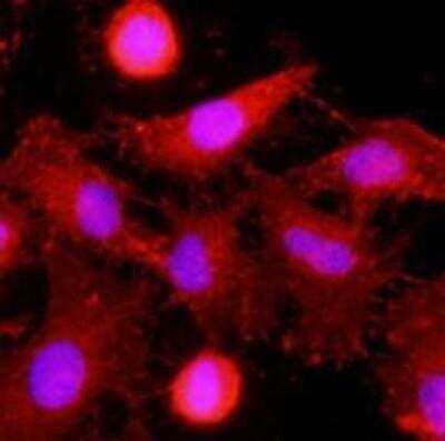 Immunocytochemistry/ Immunofluorescence: CLEC4E Antibody (16E3) - BSA Free [NBP1-49311]