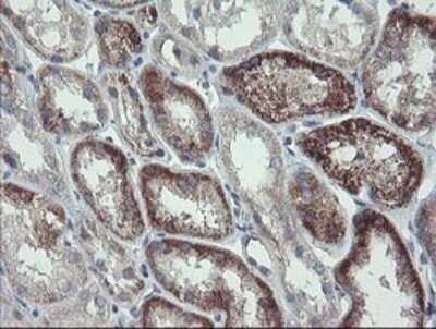 Immunohistochemistry: CLEC4E Antibody (OTI2A8) [NBP2-45629]