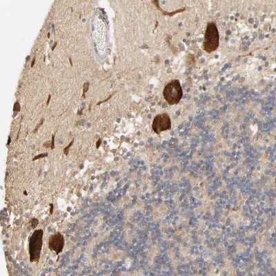 Immunohistochemistry-Paraffin: CLEC4E Antibody [NBP2-13844]