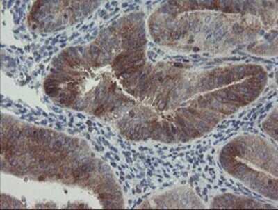 Immunohistochemistry: CLEC4E Antibody (OTI2A8) - Azide and BSA Free [NBP2-71793]