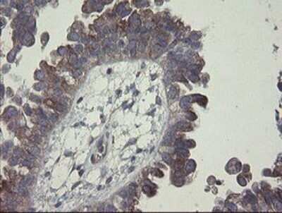 Immunohistochemistry: CLEC4E Antibody (OTI2A8) - Azide and BSA Free [NBP2-71793]