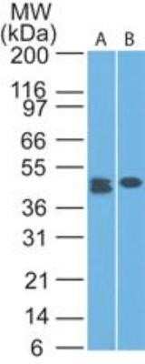 Western Blot: CLEC9a Antibody (14N8D7)Azide and BSA Free [NBP2-80673]