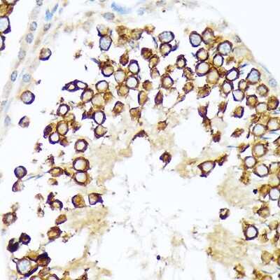 Immunohistochemistry-Paraffin: CLGN Antibody (6U8D7) [NBP3-15836]