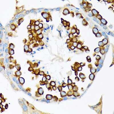 Immunohistochemistry-Paraffin: CLGN Antibody (6U8D7) [NBP3-15836]