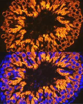 Immunohistochemistry: CLGN Antibody (8R8M1) [NBP3-15833]